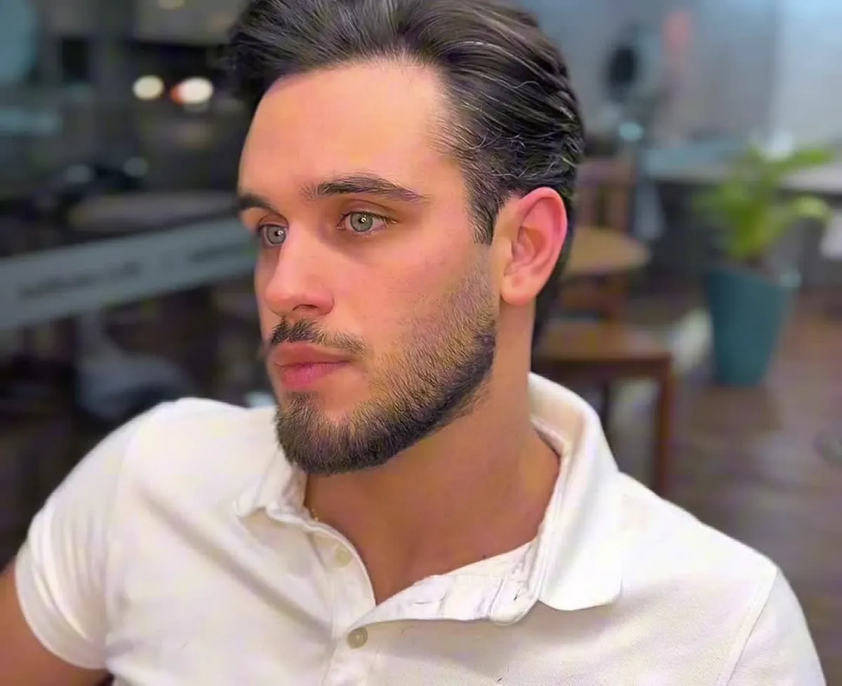 Depois: Barba Cheia Redesenhada