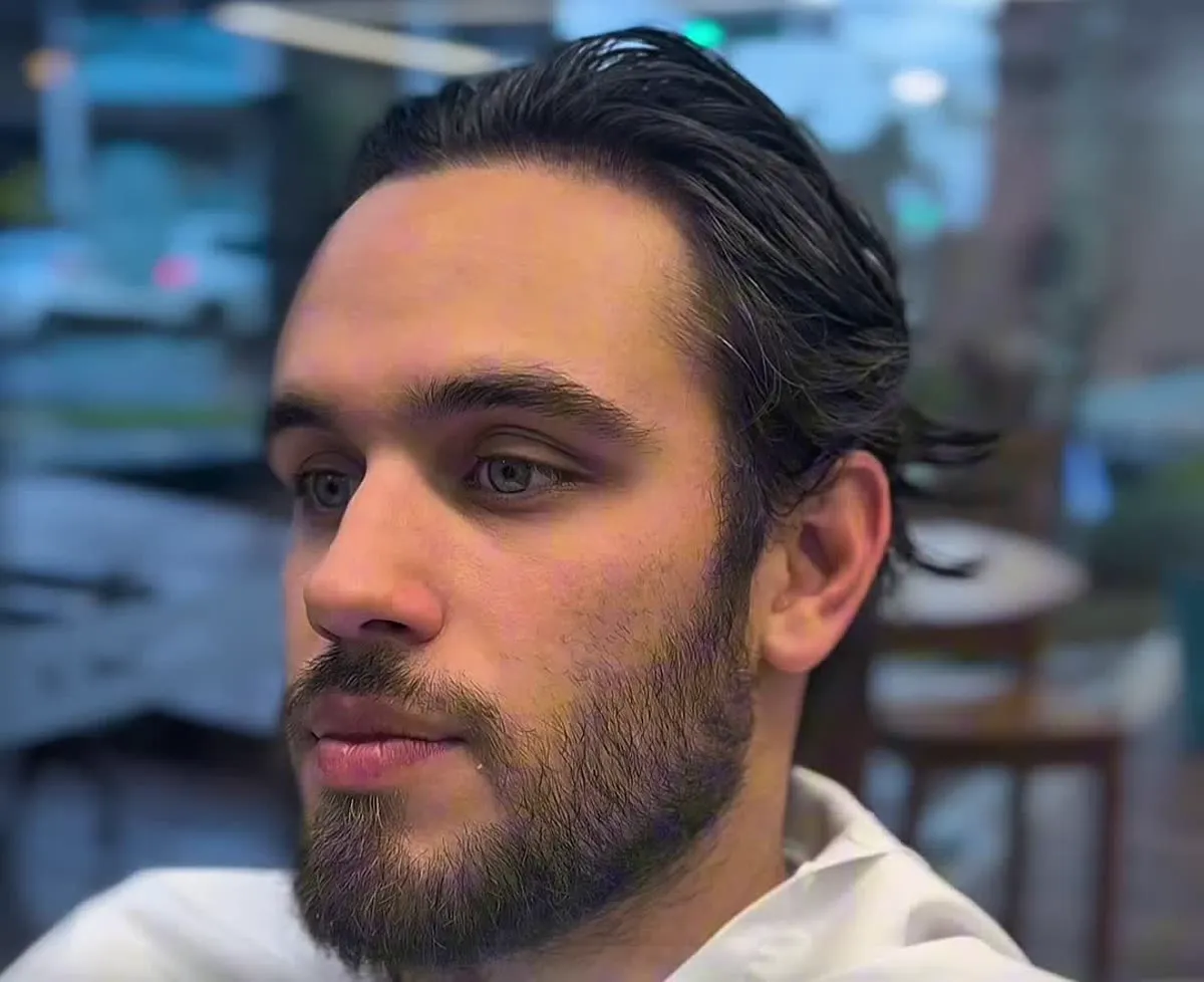 Antes: Barba Cheia Redesenhada