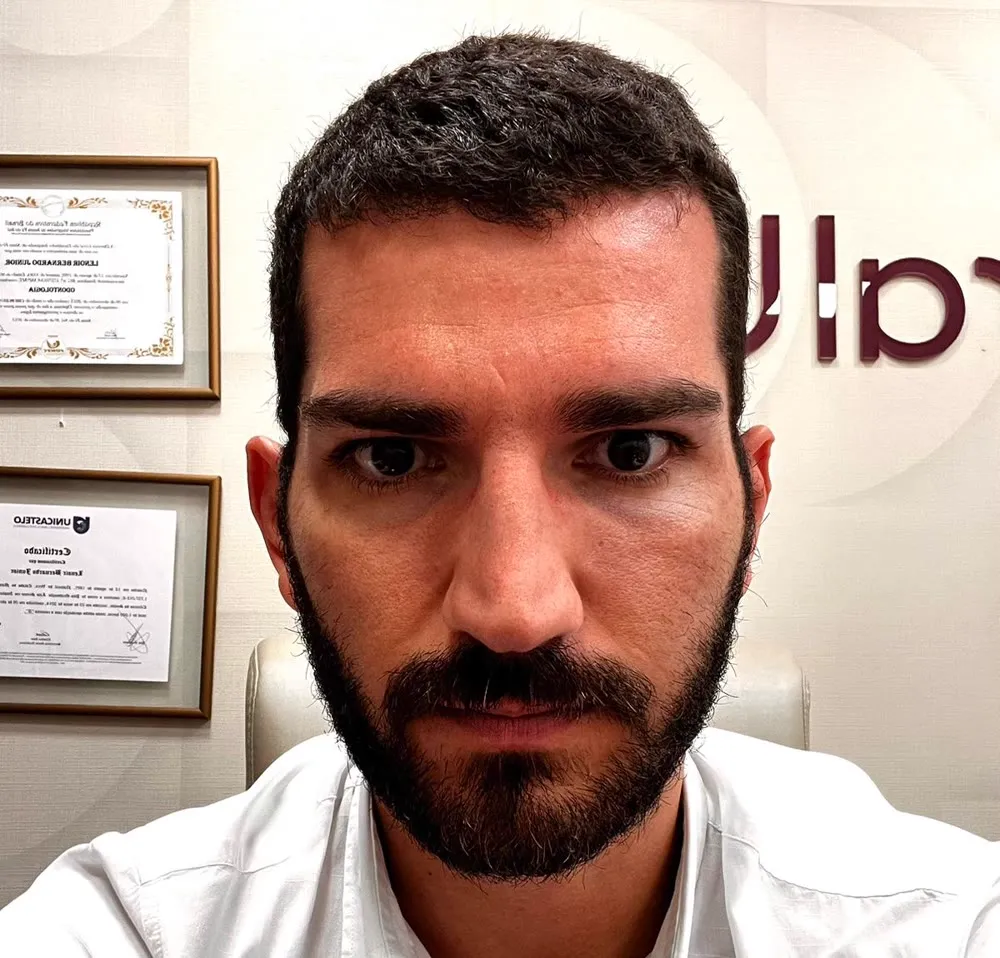 Antes: Renovação Completa de Visual